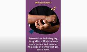Did you Know? Germs Live on Broken Skin
